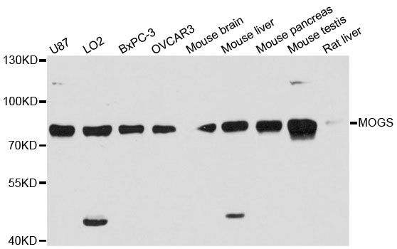 GCS1 / MOGS Antibody - Western blot analysis of extracts of various cell lines, using MOGS antibody at 1:3000 dilution. The secondary antibody used was an HRP Goat Anti-Rabbit IgG (H+L) at 1:10000 dilution. Lysates were loaded 25ug per lane and 3% nonfat dry milk in TBST was used for blocking. An ECL Kit was used for detection and the exposure time was 90s.