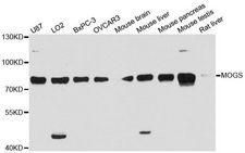 GCS1 / MOGS Antibody - Western blot analysis of extracts of various cell lines, using MOGS antibody at 1:3000 dilution. The secondary antibody used was an HRP Goat Anti-Rabbit IgG (H+L) at 1:10000 dilution. Lysates were loaded 25ug per lane and 3% nonfat dry milk in TBST was used for blocking. An ECL Kit was used for detection and the exposure time was 90s.