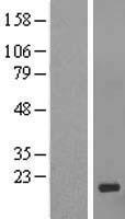 GCSAML / C1orf150 Protein - Western validation with an anti-DDK antibody * L: Control HEK293 lysate R: Over-expression lysate