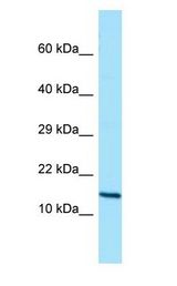 GCSH Antibody - GCSH antibody Western Blot of Placenta.  This image was taken for the unconjugated form of this product. Other forms have not been tested.