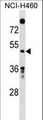GDA / Nedasin Antibody - GDA Antibody western blot of NCI-H460 cell line lysates (35 ug/lane). The GDA antibody detected the GDA protein (arrow).