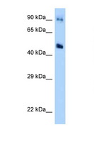 GDA / Nedasin Antibody - GDA antibody Western blot of MCF7 Cell lysate. Antibody concentration 1 ug/ml.  This image was taken for the unconjugated form of this product. Other forms have not been tested.