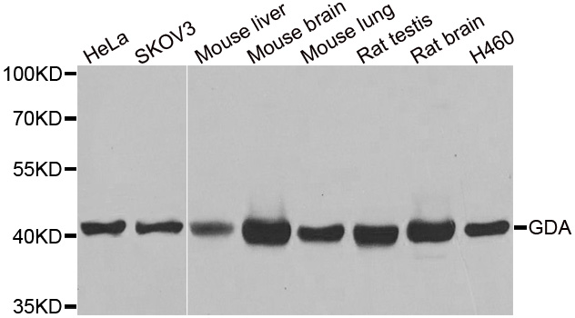 GDA / Nedasin Antibody - Western blot analysis of extracts of various cell lines.
