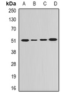 GDA / Nedasin Antibody - Western blot analysis of GDA expression in HeLa (A); SKOV3 (B); mouse lung (C); rat brain (D) whole cell lysates.