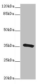 GDA / Nedasin Antibody - Western blot All Lanes: GDAantibody at 1.24ug/ml+ Hela whole cell lysate Goat polyclonal to rabbit at 1/10000 dilution Predicted band size: 52,43,53 kDa Observed band size: 36 kDa