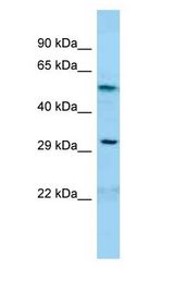GDAP1 Antibody - GDAP1 antibody Western Blot of OVCAR-3.  This image was taken for the unconjugated form of this product. Other forms have not been tested.