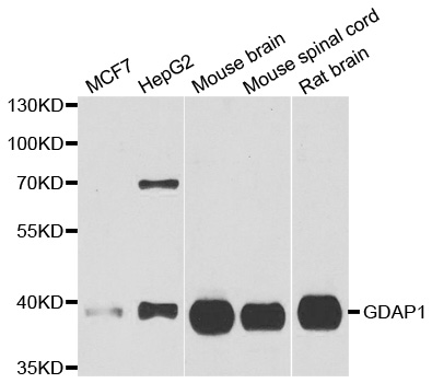 GDAP1 Antibody - Western blot analysis of extracts of various cell lines.
