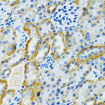 GDAP1 Antibody - Immunohistochemistry of paraffin-embedded rat kidney tissue.
