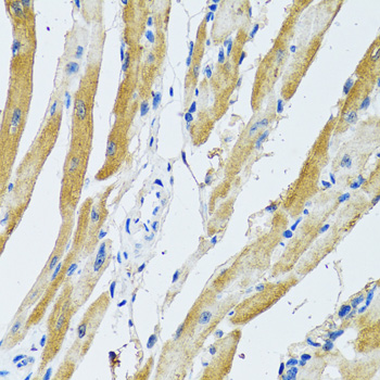 GDAP1 Antibody - Immunohistochemistry of paraffin-embedded rat heart tissue.
