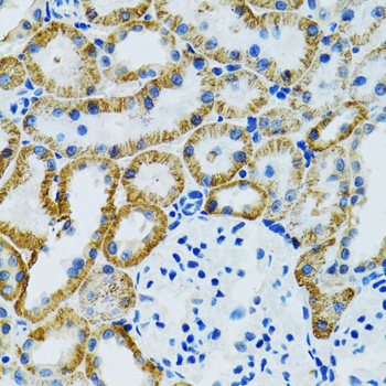 GDAP1 Antibody - Immunohistochemistry of paraffin-embedded mouse kidney tissue.