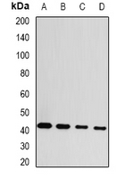 GDAP1 Antibody - Western blot analysis of GDAP1 expression in MCF7 (A); HepG2 (B); mouse brain (C); rat brain (D) whole cell lysates.