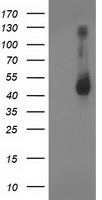 GDAP1L1 Antibody - HEK293T cells were transfected with the pCMV6-ENTRY control (Left lane) or pCMV6-ENTRY GDAP1L1 (Right lane) cDNA for 48 hrs and lysed. Equivalent amounts of cell lysates (5 ug per lane) were separated by SDS-PAGE and immunoblotted with anti-GDAP1L1.