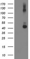 GDAP1L1 Antibody - HEK293T cells were transfected with the pCMV6-ENTRY control (Left lane) or pCMV6-ENTRY GDAP1L1 (Right lane) cDNA for 48 hrs and lysed. Equivalent amounts of cell lysates (5 ug per lane) were separated by SDS-PAGE and immunoblotted with anti-GDAP1L1.