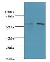 GDAP2 Antibody - Western blot. All lanes: GDAP2 antibody at 2 ug/ml Lane 1:mouse liver tissue. Lane 2: MCF-7 whole cell lysate. Secondary antibody: Goat polyclonal to rabbit at 1:10000 dilution. Predicted band size: 56 kDa. Observed band size: 56 kDa.  This image was taken for the unconjugated form of this product. Other forms have not been tested.