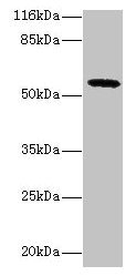 GDAP2 Antibody - Western blot All lanes: GDAP2 antibody at 2µg/ml + MCF-7 whole cell lysate Secondary Goat polyclonal to rabbit IgG at 1/10000 dilution Predicted band size: 56 kDa Observed band size: 56 kDa
