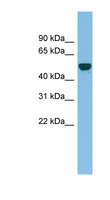 GDAP2 Antibody - GDAP2 antibody Western blot of NCI-H226 cell lysate. This image was taken for the unconjugated form of this product. Other forms have not been tested.