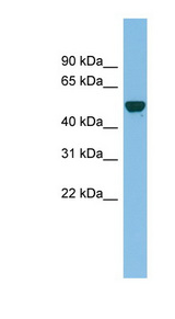 GDAP2 Antibody - GDAP2 antibody Western blot of NCI-H226 cell lysate. This image was taken for the unconjugated form of this product. Other forms have not been tested.