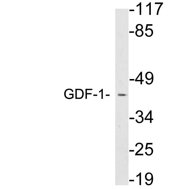 GDF1 Antibody - Western blot analysis of lysates from brain tissue, using GDF-1 antibody.