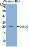 GDF10 / BMP3B Antibody - Western blot of recombinant GDF10 / BIP.