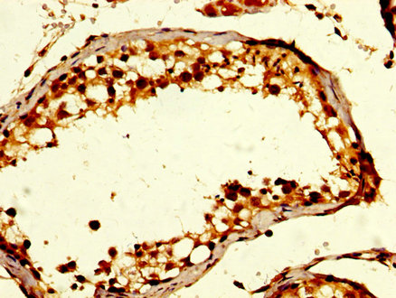 GDF10 / BMP3B Antibody - Immunohistochemistry image at a dilution of 1:200 and staining in paraffin-embedded human testis tissue performed on a Leica BondTM system. After dewaxing and hydration, antigen retrieval was mediated by high pressure in a citrate buffer (pH 6.0) . Section was blocked with 10% normal goat serum 30min at RT. Then primary antibody (1% BSA) was incubated at 4 °C overnight. The primary is detected by a biotinylated secondary antibody and visualized using an HRP conjugated SP system.