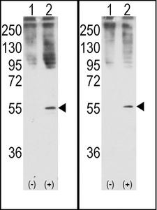 GDF11 / GDF-11 Antibody - Western blot of GDF11 (arrow) using rabbit polyclonal GDF11 Antibody (R47). 293 cell lysates (2 ug/lane) either nontransfected (Lane 1) or transiently transfected with the GDF11 gene (Lane 2) (Origene Technologies).