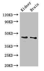 GDF11 / GDF-11 Antibody - Positive WB detected in:Mouse kidney tissue,Mouse brain tissue;All lanes:GDF11 antibody at 3?g/ml;Secondary;Goat polyclonal to rabbit IgG at 1/50000 dilution;Predicted band size: 46 KDa;Observed band size: 46 KDa;