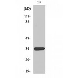 GDF15 Antibody - Western blot of GDF-15 antibody