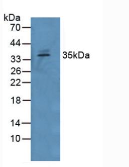 GDF15 Antibody - Western Blot; Sample: Human Serum.