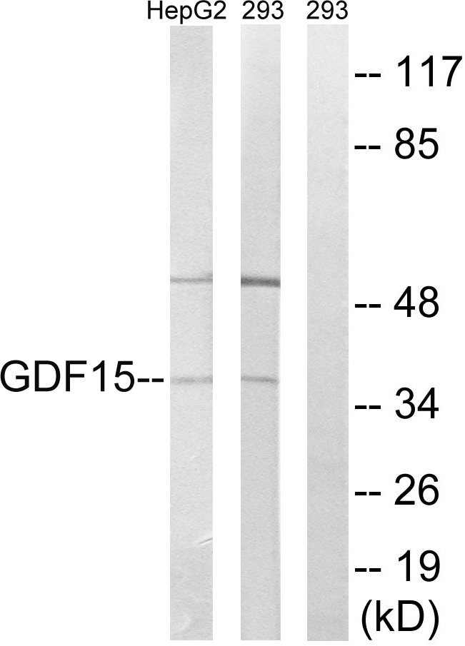 GDF15 Antibody - Western blot analysis of lysates from 293 and HepG2 cells, using GDF15 Antibody. The lane on the right is blocked with the synthesized peptide.