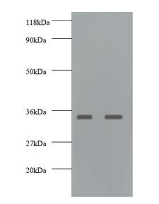 GDF15 Antibody - Western blot of Growth/differentiation factor 15 antibody at 2 ug/ml. Lane 1: EC109 whole cell lysate. Lane 2: 293T whole cell lysate. Secondary: Goat polyclonal to rabbit IgG at 1:10000 dilution. Predicted band size: 34 kDa. Observed band size: 34 kDa.  This image was taken for the unconjugated form of this product. Other forms have not been tested.