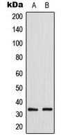 GDF15 Antibody - Western blot analysis of GDF15 expression in HepG2 (A); NIH3T3 (B) whole cell lysates.