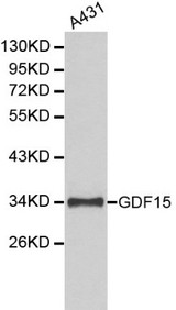 GDF15 Antibody - Western blot of GDF15 pAb in extracts from A431 cells.