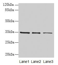 GDF15 Antibody - Western blot All lanes: Growth/differentiation factor 15 antibody at 2µg/ml Lane 1: EC109 whole cell lysate Lane 2: 293T whole cell lysate Secondary Goat polyclonal to rabbit IgG at 1/10000 dilution Predicted band size: 34 kDa Observed band size: 34 kDa