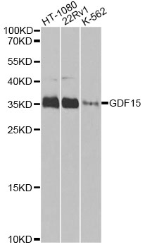GDF15 Antibody - Western blot analysis of extracts of various cell lines, using GDF15 antibody at 1:1000 dilution. The secondary antibody used was an HRP Goat Anti-Rabbit IgG (H+L) at 1:10000 dilution. Lysates were loaded 25ug per lane and 3% nonfat dry milk in TBST was used for blocking. An ECL Kit was used for detection and the exposure time was 90s.