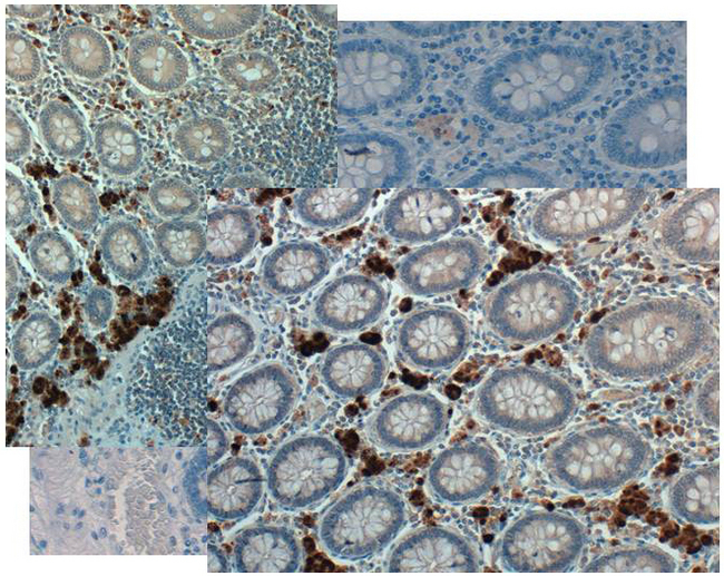 GDF15 Antibody - Immunohistochemistry of rabbit anti NAG1 antibody. Tissue: Human Colon at 20X in colon tissue at pH 6. Negative control of human colon tissue pH6 is shown in background.