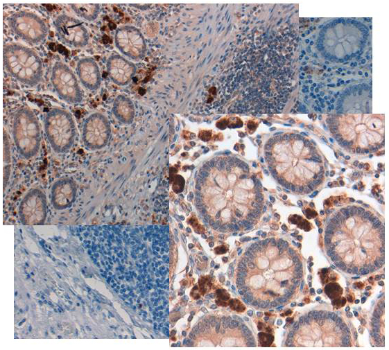 GDF15 Antibody - Immunohistochemistry of rabbit anti NAG1 antibody. Tissue: Human Colon at 20X in colon tissue at pH 6. Negative control of human colon tissue pH6 is shown in background.