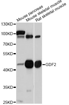 GDF2 / BMP9 Antibody - Western blot analysis of extracts of various cell lines, using GDF2 antibody at 1:1000 dilution. The secondary antibody used was an HRP Goat Anti-Rabbit IgG (H+L) at 1:10000 dilution. Lysates were loaded 25ug per lane and 3% nonfat dry milk in TBST was used for blocking. An ECL Kit was used for detection and the exposure time was 5s.
