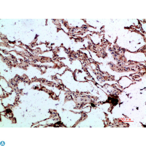 GDF2 / BMP9 Antibody - Immunohistochemical analysis of paraffin-embedded human-lung, antibody was diluted at 1:200.