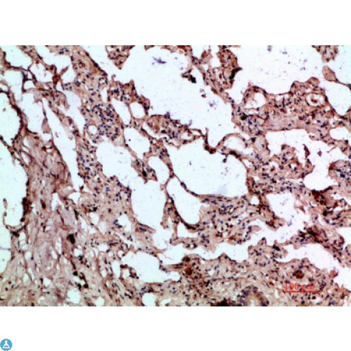 GDF2 / BMP9 Antibody - Immunohistochemical analysis of paraffin-embedded human-lung, antibody was diluted at 1:200.