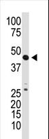 GDF3 Antibody - The anti-GDF3 N-term antibody is used in Western blot to detect GDF3 in mouse kidney tissue lysate.