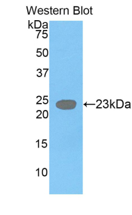 GDF3 Antibody - Western blot of GDF3 antibody.