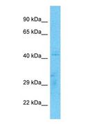 GDF3 Antibody - Western blot of GDF3 Antibody with human Jurkat Whole Cell lysate.  This image was taken for the unconjugated form of this product. Other forms have not been tested.