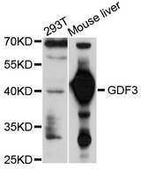 GDF3 Antibody - Western blot analysis of extracts of various cell lines.
