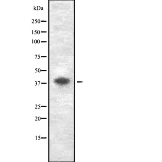 GDF3 Antibody - Western blot analysis GDF3 using Jurkat whole cells lysates