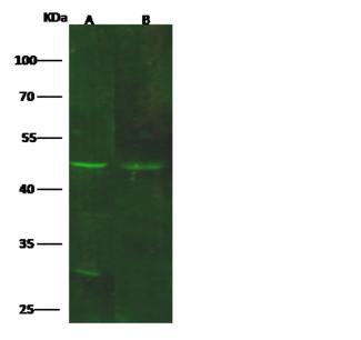 GDF3 Antibody - Anti-GDF3 rabbit polyclonal antibody at 1:500 dilution. Lane A: HepG2 Whole Cell Lysate. Lane B: SH-SY5Y Whole Cell Lysate. Lysates/proteins at 30 ug per lane. Secondary: Goat Anti-Rabbit IgG H&L (Dylight 800) at 1/10000 dilution. Developed using the Odyssey technique. Performed under reducing conditions. Predicted band size: 41 kDa. Observed band size: 46 kDa. (We are unsure as to the identity of these extra bands.)