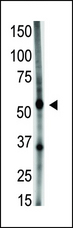 GDF5 / GDF-5 Antibody - The anti-GDF5 N-term antibody is used in Western blot to detect GDF5 in A549 cell lysate.