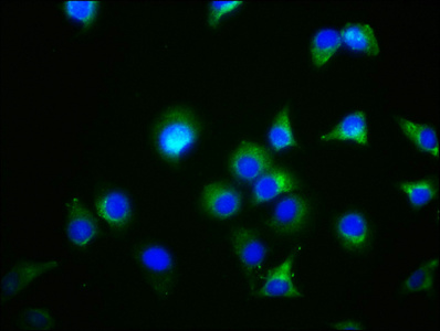 GDF5 / GDF-5 Antibody