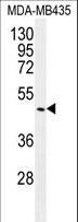 GDF5 / GDF-5 Antibody - GDF5 Antibody western blot of MDA-MB435 cell line lysates (35 ug/lane). The GDF5 antibody detected the GDF5 protein (arrow).