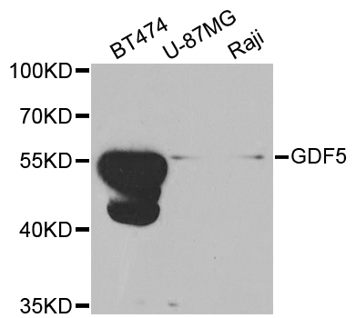 GDF5 / GDF-5 Antibody - Western blot analysis of extracts of various cell lines.
