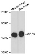 GDF5 / GDF-5 Antibody - Western blot analysis of extracts of various cell lines, using GDF5 antibody at 1:3000 dilution. The secondary antibody used was an HRP Goat Anti-Rabbit IgG (H+L) at 1:10000 dilution. Lysates were loaded 25ug per lane and 3% nonfat dry milk in TBST was used for blocking. An ECL Kit was used for detection and the exposure time was 90s.